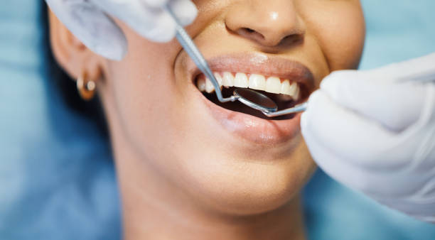 Best Emergency Wisdom Teeth Removal in Sublimity, OR